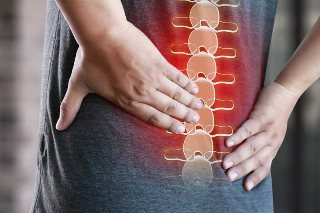 Sciatica Back Pain
